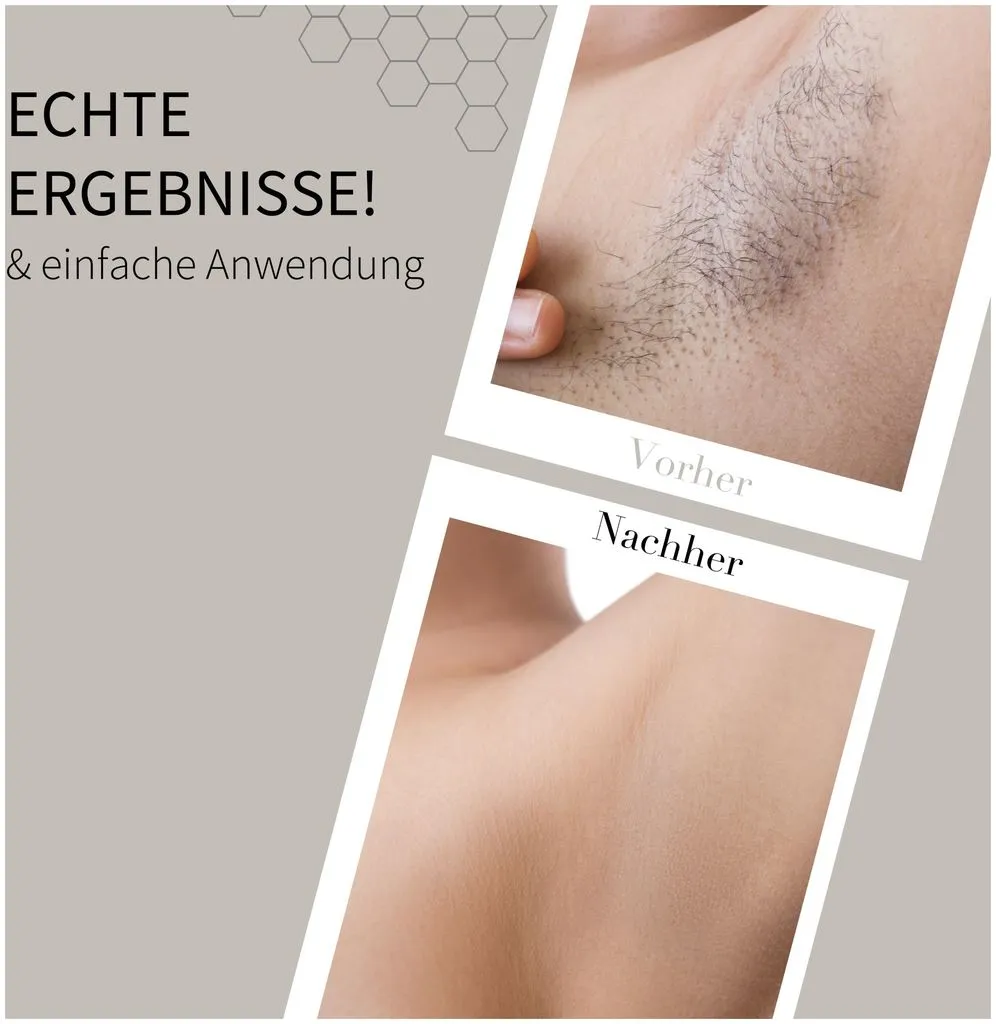 Fleeky Wax Kit Roller