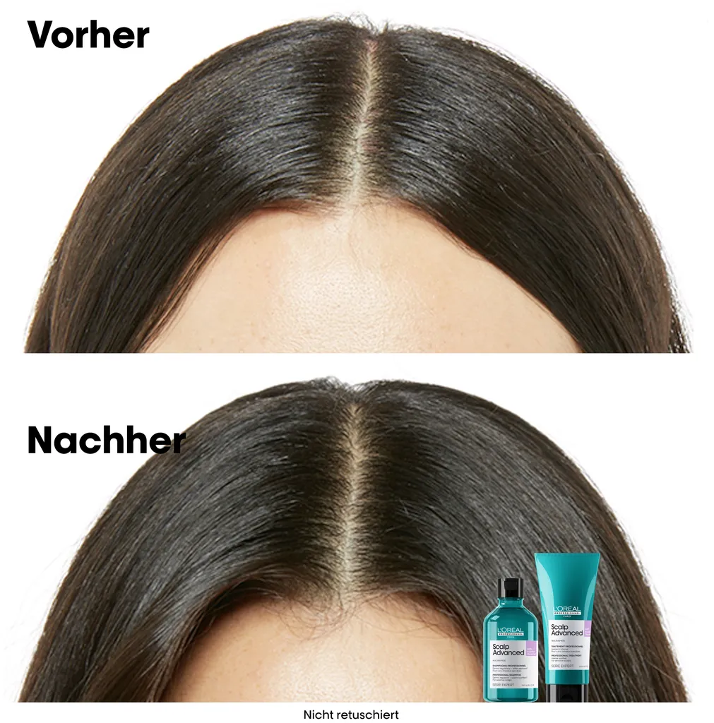 L'Oréal Scalp Advanced Anti-Discomfort Dermo-Regulator Shampoo